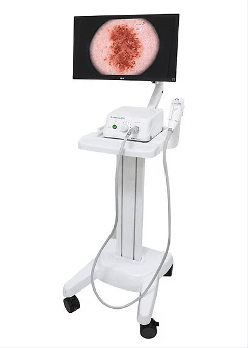 Video Colposcope Dr. Camscope Pro by JY Sometech — image 2