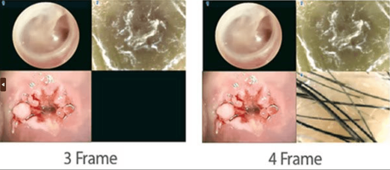 Video Colposcope Dr. Camscope Pro by JY Sometech — image 6