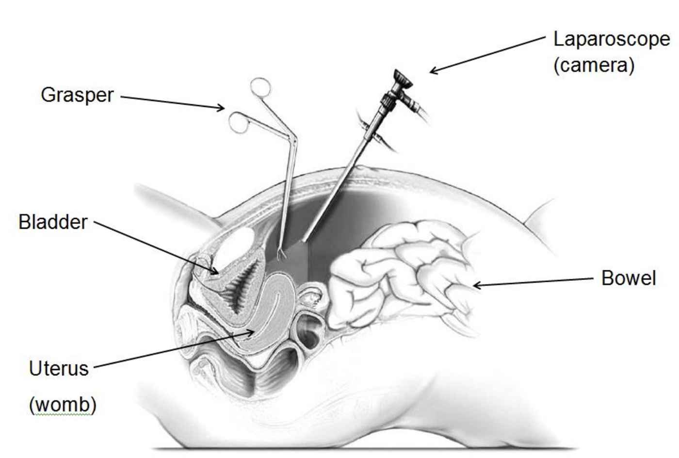 VES-100 2D Endoscopy Camera System by JY Sometech — image 5