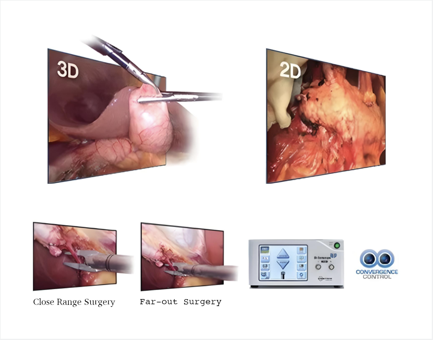 VLS-200 3D Laparoscopy System by JY Sometech — image 2