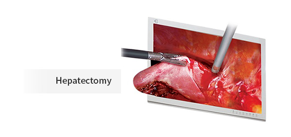 VLS-200 3D Laparoscopy System by JY Sometech — image 7