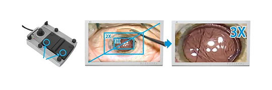 VOMS-100 3D Operating Microscope (Ophthalmology) by JY Sometech — image 6