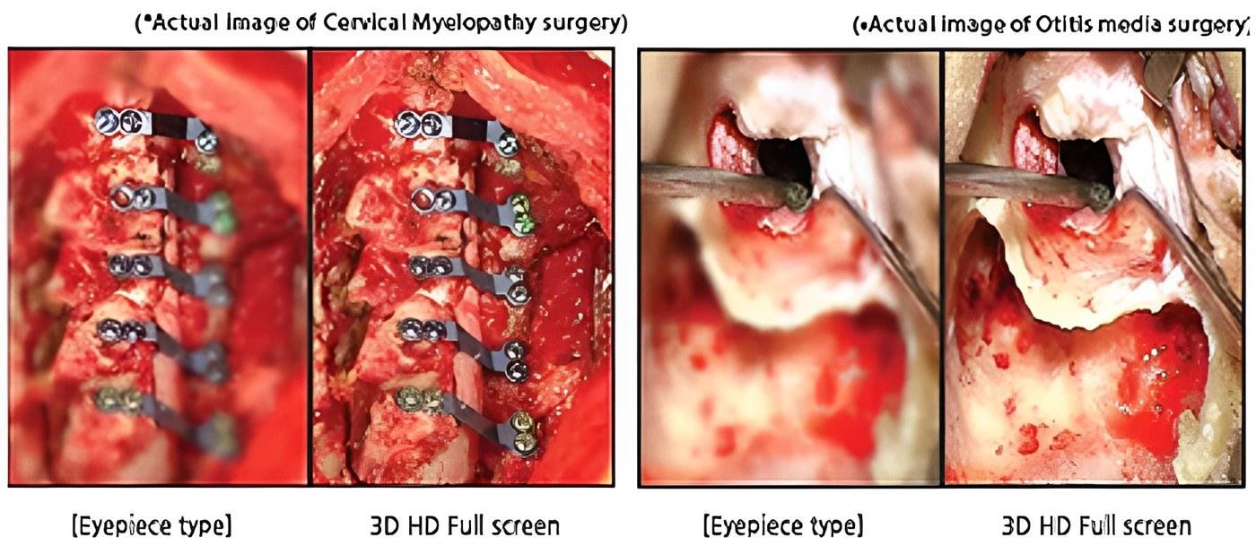 VOMS-101 3D Operating Microscope (Spine / Brain) by JY Sometech — image 2
