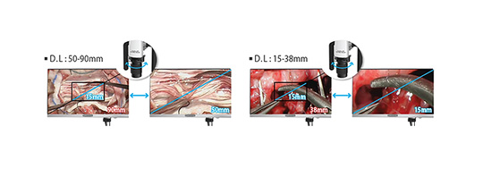 VOMS-101 3D Operating Microscope (Spine / Brain) by JY Sometech — image 6