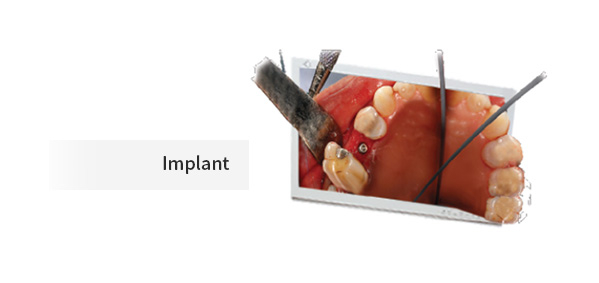 VOMS-102D 3D Operating Microscope (Dental) by JY Sometech — image 7